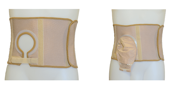 Parastomal hotsell hernia belt